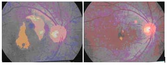 armd-fig-2