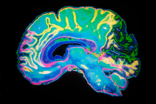 Colourful cross section of the brain