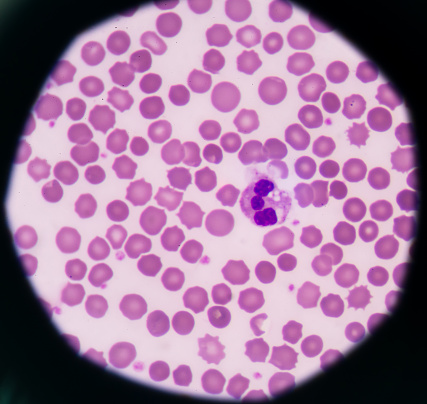 Microscopic image of pink and purple cells