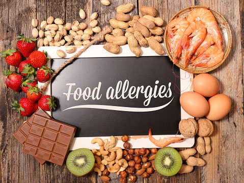 A board surrounded by food with the words 'food allergies' written on it