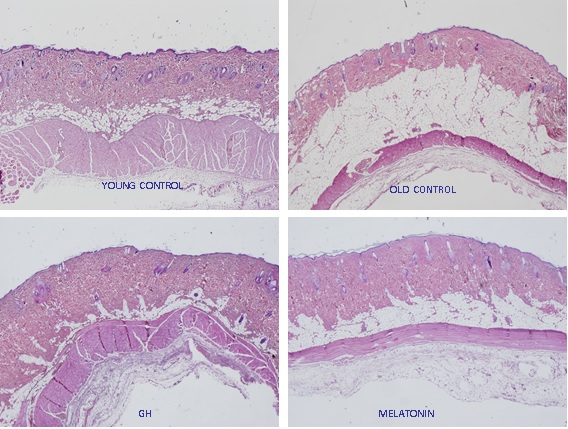 melatonin-fig-1