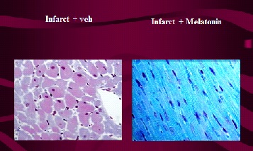 melatonin-fig-2