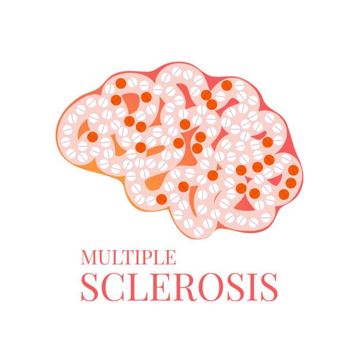 Cartoon brain with red and white pills inside next to pink Multiple Sclerosis text