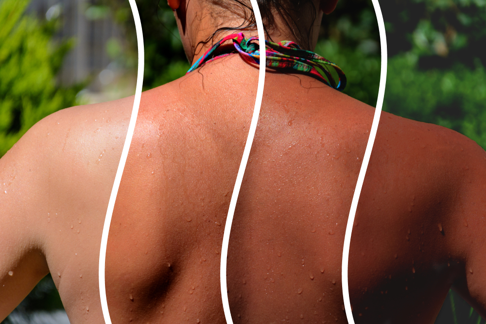 A woman's back in the sun with a gradient of lighter skin to darker skin